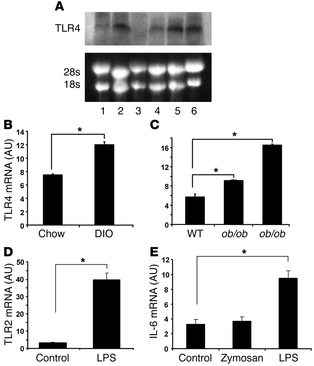 Figure 3 Adipocytes express functional TLR4, and TLR4 expression is increased in adipose tissue of obese models. (A) Adipocytes express TLR4. Northern blotting was used to detect TLR4 mrna expression.