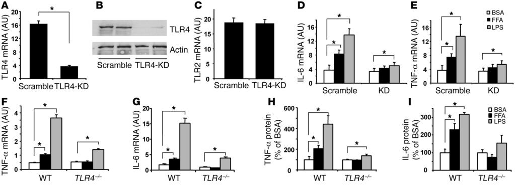 Figure 4 FFAs cause inflammatory response via TLR4 in adipocytes. (A C) Generation of an adipocyte model with specific TLR4 knockdown.