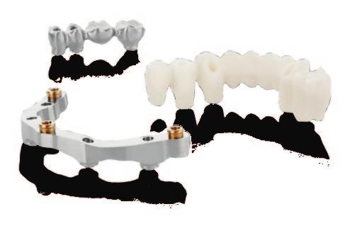 NobelProcera CAD/CAM for restorative flexibility and predictable results Titanium or zirconia abutments that support the surrounding tissue with an individualized emergence profile