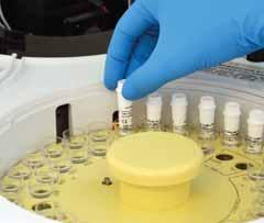 solution. Turbilatex reagents are developed to obtain a high sensitivity detection method. + + Polystyrene latex particles coated with antibodies.