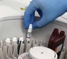 The intended use for Turbilatex products is to detect and quantify the antigen present in human stool samples. Equipment needed: Biochemistry analyzer.