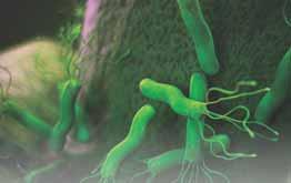_H. pylori Turbilatex Helicobacter pylori (H. pylori) is a spiral-shaped bacterium that is found in the gastric mucous layer or adherent to the epithelial lining of the stomach. H. pylori causes more than 90% of duodenal ulcers and up to 80% of gastric ulcers.