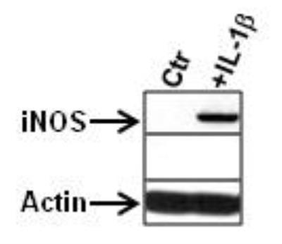Western Blot: inos Antibody [NB300-605] - inos in stimulated astrocytes. Image from verified customer review.