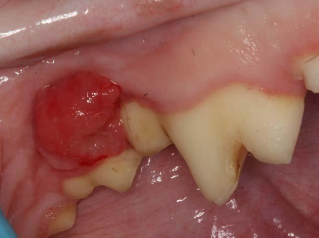Acanthomatous Ameloblastoma (CAA) Canine acanthomatous ameloblastoma is an odontogenic tumor. That means that it arises from the structures that support the teeth.