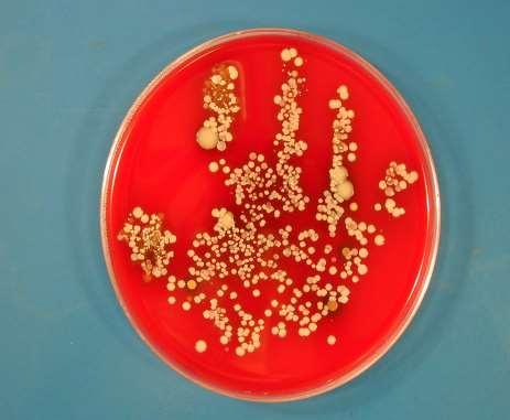 Many personnel don t realize when they have germs on their hands Healthcare providers can get 1000s of bacteria on their hands by doing simple tasks, like pulling patients up in bed taking a blood
