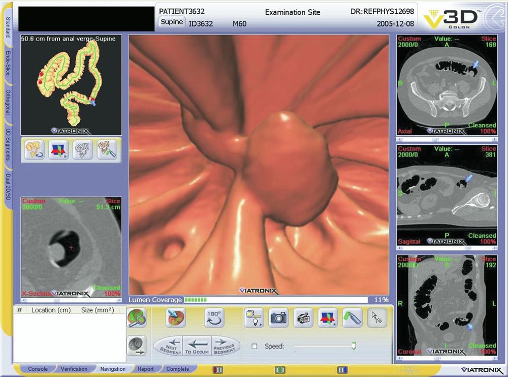 500 PICKHARDT AND KIM CLINICAL GASTROENTEROLOGY AND HEPATOLOGY Vol. 6, No. 5 Figure 2. Screen capture of the CTC software system used for interpretation at the University of Wisconsin.