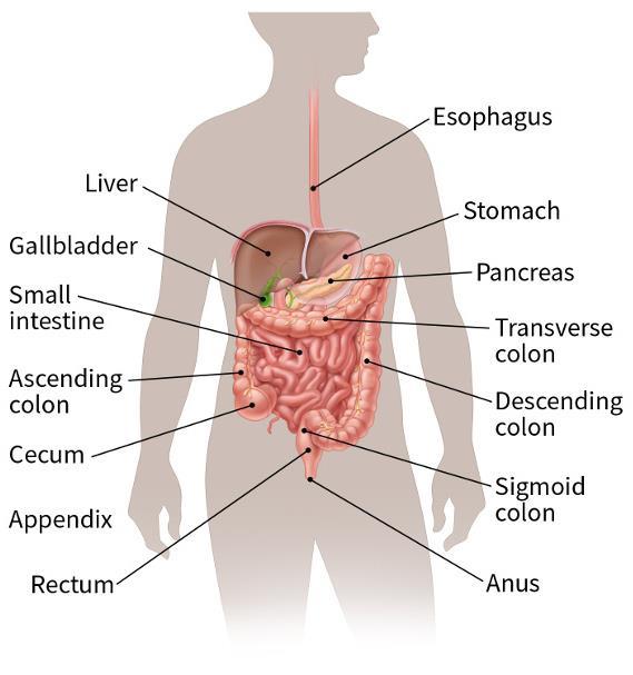 What is colorectal cancer?