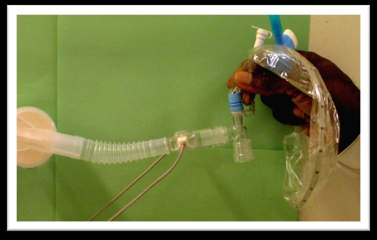 When using the CO2 sensor in a ventilator circuit with an inline suction catheter, position the disposable airway adapter to the side of the circuit so that the catheter does not go through the