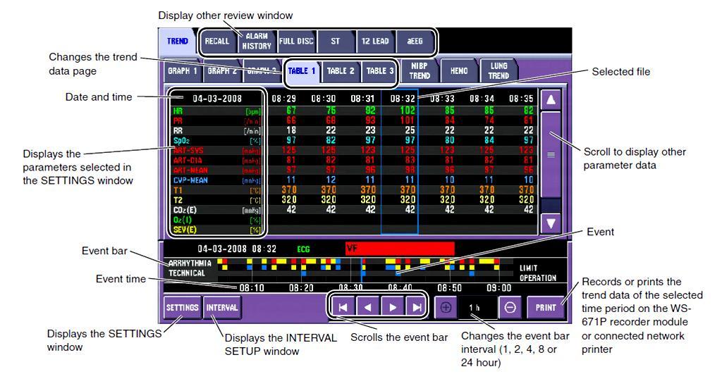Review the CO2 Trends The capnography data is stored with the other vital sign information in the Review window on the bedside monitor.