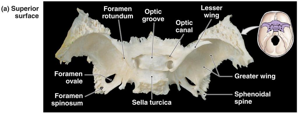 The Cranial Bones of the