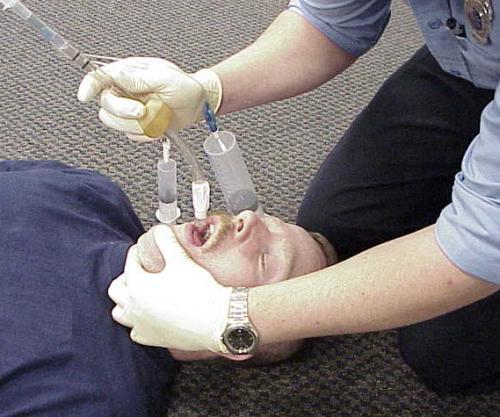 Procedures Insertion Procedures Position the patient s neck in a neutral position.