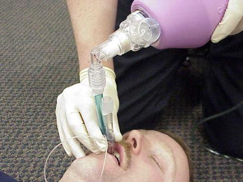 Insertion Procedures Begin ventilation through the longer blue tube labeled #1. If auscultation of breath sounds is good and gastric inflation is negative, continue.