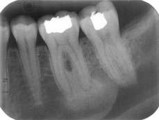 associations with teeth internal structure effects on adjacent structures the absence of a