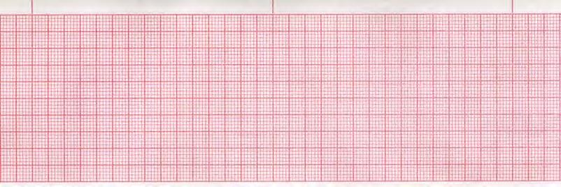 Step 2 Calculate the Heart Rate ECG PAPER The ECG is recorded on ruled paper.