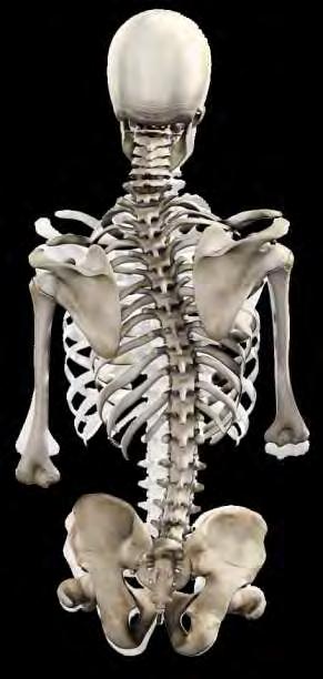 PELVIC OBLIQUITY AND SCOLIOSIS CLINICAL PRESENTATION The obliquity is referred to by the lower