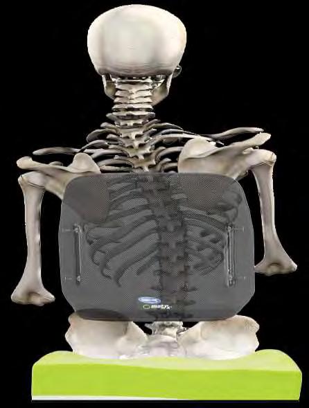 PELVIC OBLIQUITY AND SCOLIOSIS FIXED POSTURE Ensure lateral