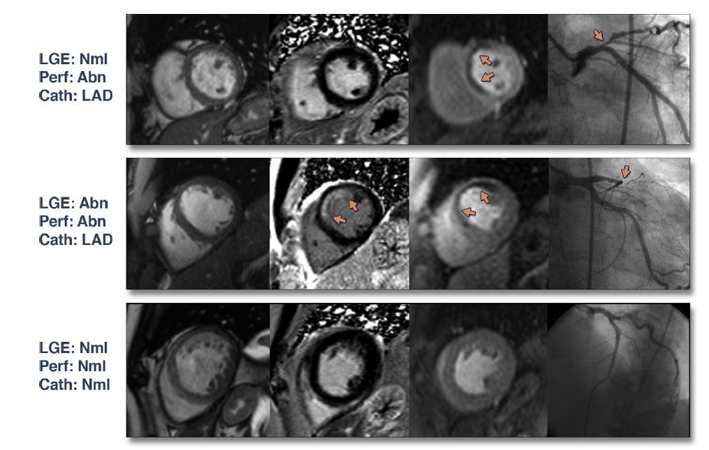 Myocardial Perfusion Imaging Wang et al.