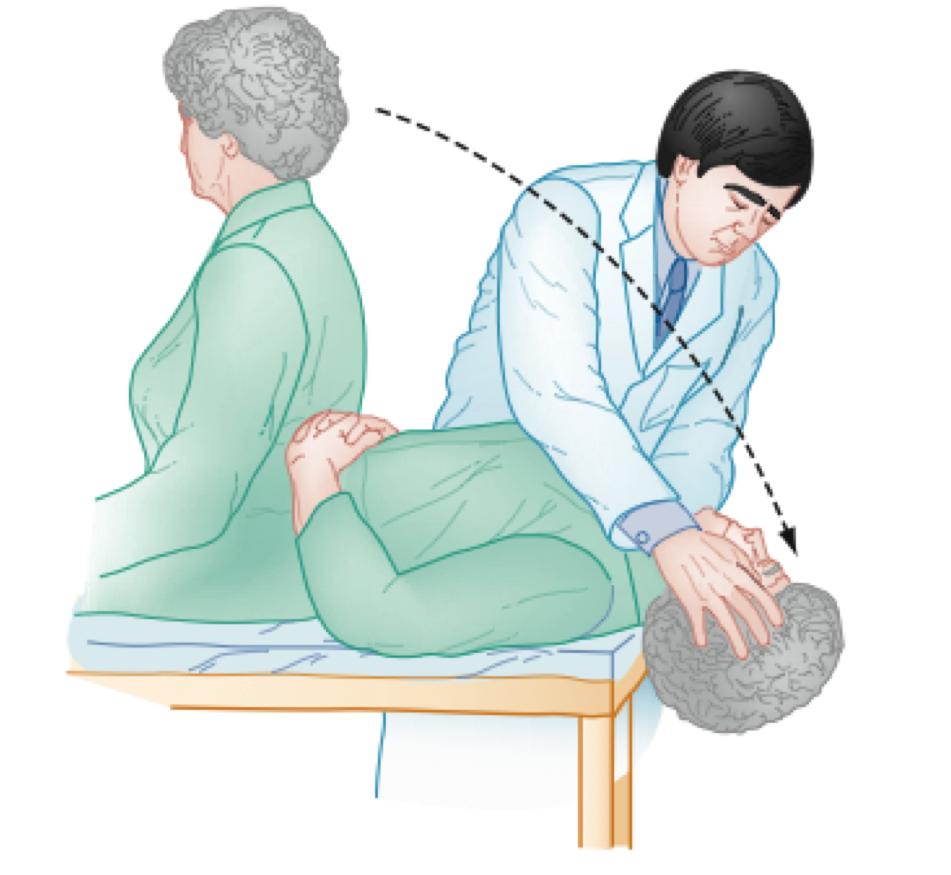 4) Describe the Hallpike Maneuver and the Epley Maneuver Dix-Hallpike Maneuver Can confirm the diagnosis of posterior canal BPPV Useful diagnostic tool EXPLANATION I.