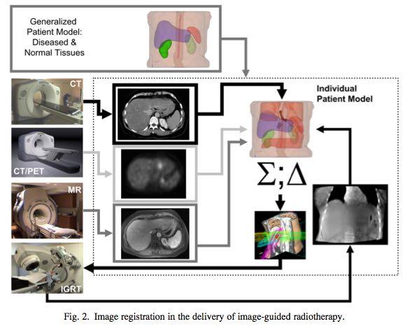More than just IMRT The simultaneous implementation of supplementary technology * imaging modalities image guidance computer software IT systems radiobiology dose painting.
