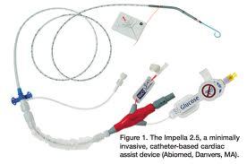 IMPELLA Protect 1 Trial Determine safety and efficacy of placement Patients having high-risk PCI, all with