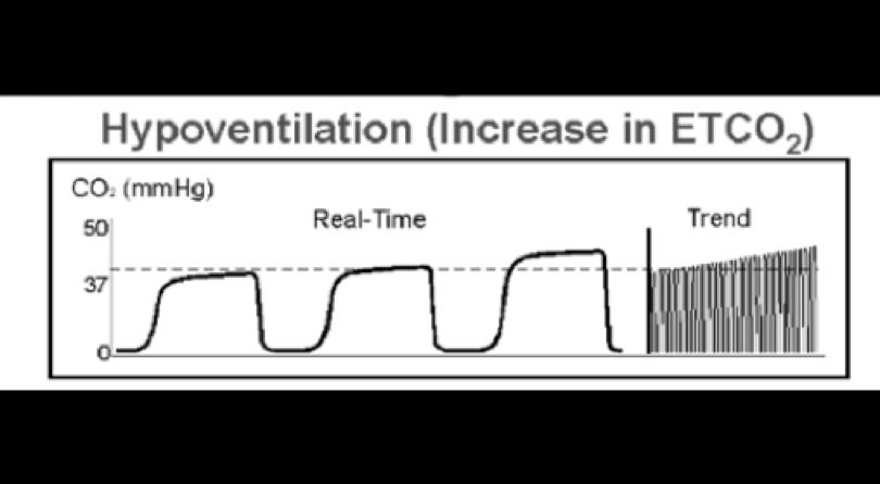 Hypoventilation When ETC02 is retained, it builds up in the body and alters the ph of the blood. This ph alteration hits the chemoreceptors in the brain.