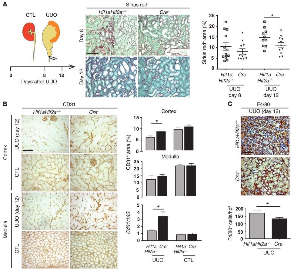 research article Figure 2 Endothelial HIF protects from UUO-induced renal injury and inflammation.
