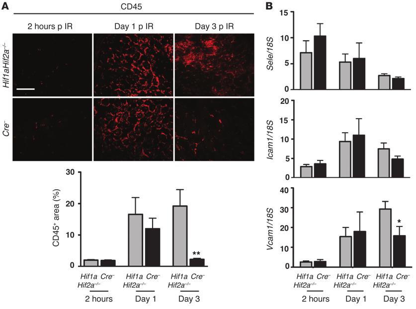 Figure 5 Endothelial HIF suppresses IRI-associated renal inflammation.