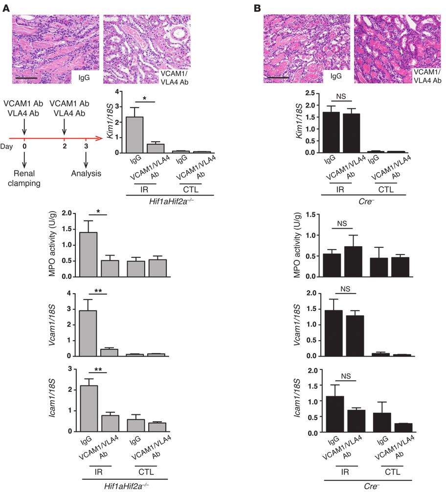 Figure 6 Blockade of VCAM1/VLA4 reverses renal injury associated with endothelial HIF deletion.