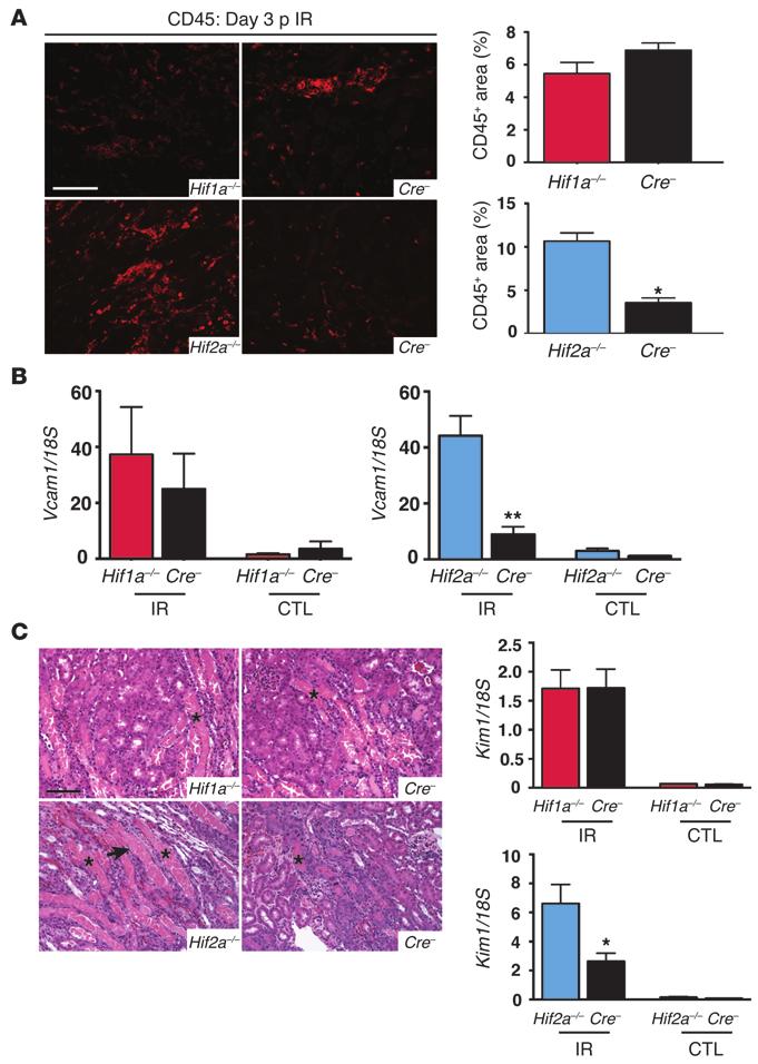 Figure 7 Inactivation of endothelial HIF-2α but not HIF-1α impairs recovery from kidney injury and inflammation.