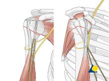 Remember that the humeral head is normally retroverted, facing approximately 25 posteriorly (mean range: 18-30 ) relative to the distal humeral epicondylar axis.