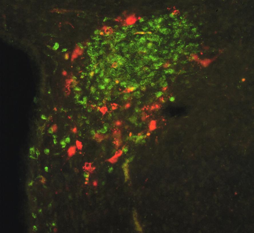 Stress-related PVN components Endocrine neurons (green) that make/ release CRH Corticotropicreleasing hormone