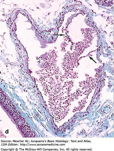 (d): Micrograph of a medium vein containing blood and showing valve folds (arrows). X200. Masson trichrome.
