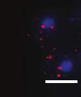 Cells lacking CP-GFP expression are grown in YPD rich media while those expressing CP-GFP are grown