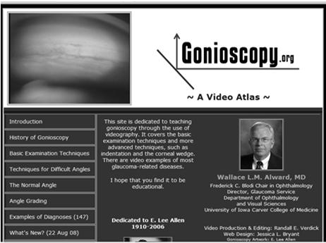 Gonioscopy on the Web! Video www.gonioscopy.
