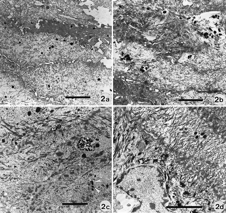 VOL. 111, NO. 6 DECEMBER 1998 PIGMENTATION AND PHOTOPROTECTION EX VIVO 1105 Figure 2. Electron microscopy of heterologous reconstructed phototypes.