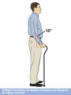 Canes a few facts 10% of >65 use canes Carry cane opposite to weak leg Size to middle of wrist Look forward, not down