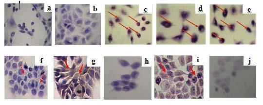 Figure 3. Imunocytochemistry assay of expression of apoptosis regulator proteins p53 (a-e) and Bcl-2 (f-j) by using combination of ethanolic CPE with doxorubicin in MCF-7 cell line.