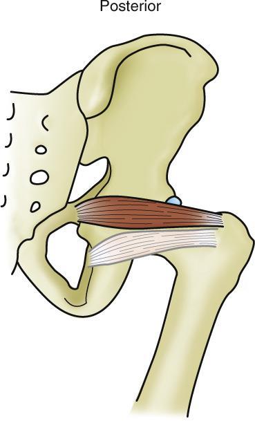 Deep Lateral Rotators of the Thigh at the Hip
