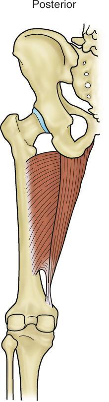 Muscles of the Medial Thigh III Adductor magnus What is the referred pain pattern of the adductor magnus?