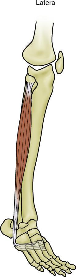 Lateral Muscles What is the isometric function of the fibularis (peroneus) longus? (It stabilizes the ankle joint.