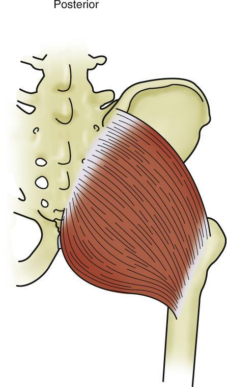 Muscles of the Gluteal Region I Gluteus maximus It extends and laterally