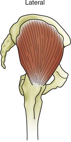 Gluteus medius What is the referred pain pattern of the gluteus medius?