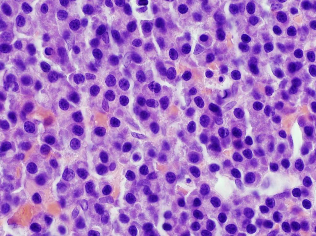Histologic Description: The cells are round with distinct cell margins and a moderate amount of pale basophilic