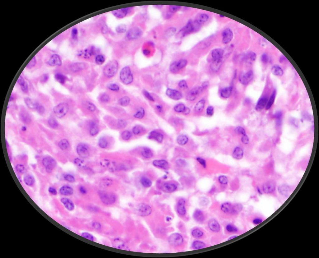 Spleen Histologic Description The cells consist