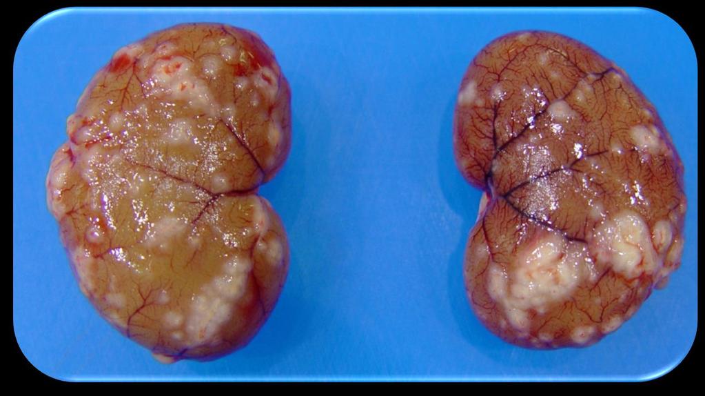 These lesions can easily be mistaken for renal