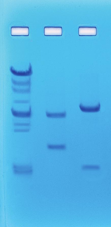 Using the PCR-RFLP Method to Characterize p53 A B A B Cat.