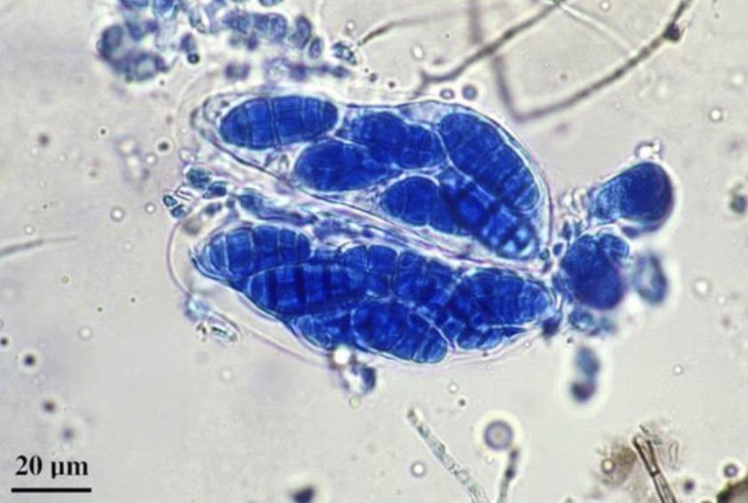 Spores Asexual Only mitotic cell division.