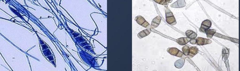 b)chlamydospores in or on hyphae
