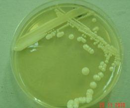 Yeast: (Morphology ) Candida albicans is #1