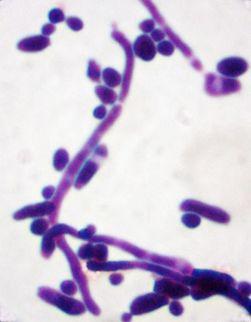 Examples : Candida albicans, Saccharomyces